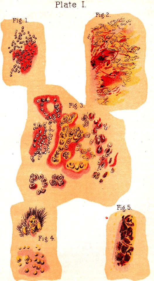 Illustration:
Plate I. Fig. 1. Fig. 2. Fig. 3. Fig. 4. Fig. 5.