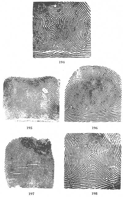 Figs. 194-198