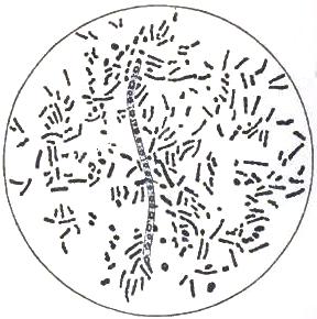 Bacillus anthracis